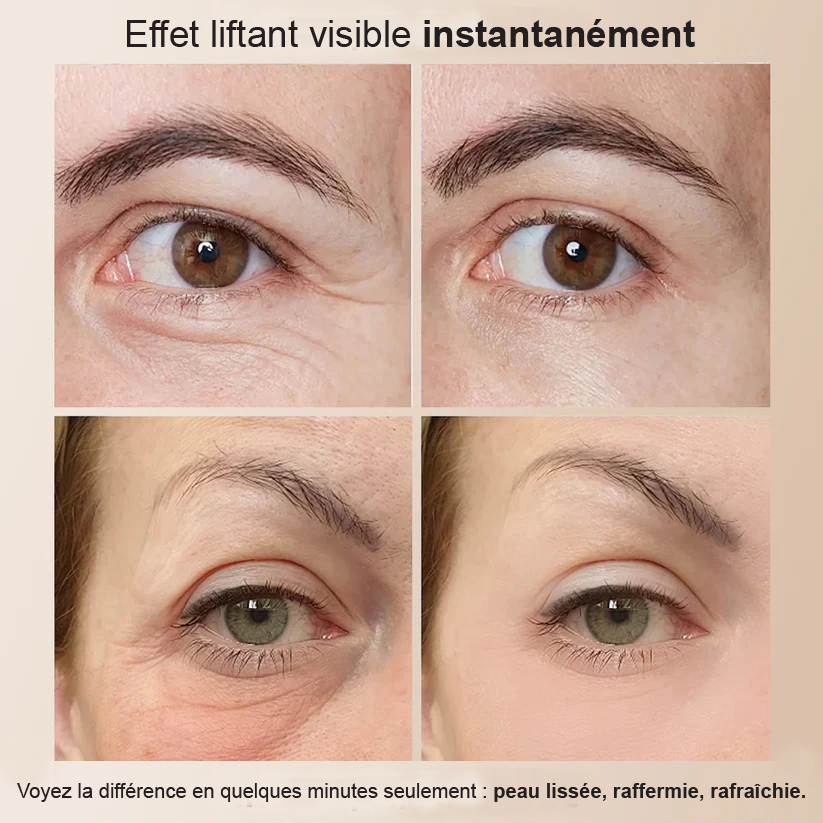 NeutraLift Temporary Eye